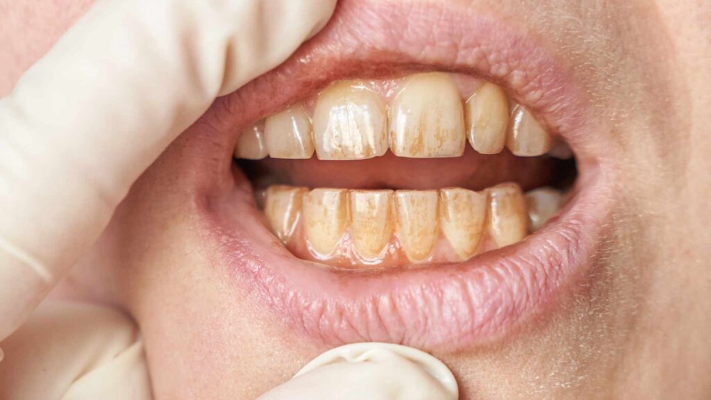 Kezelesek fogagybetegseg 01 3t dental pecs