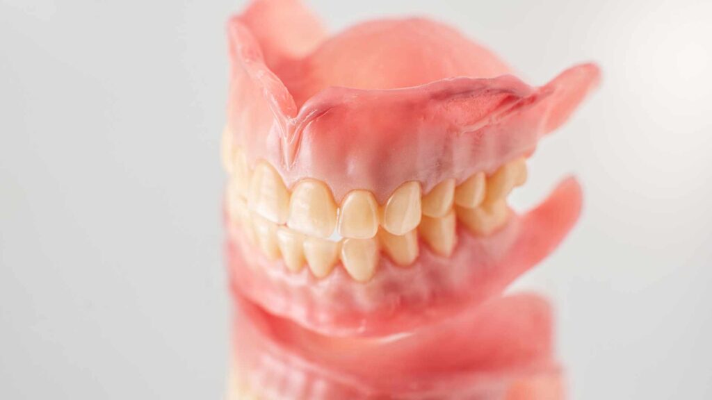 Kezelesek fogsorok 01 3t dental pecs