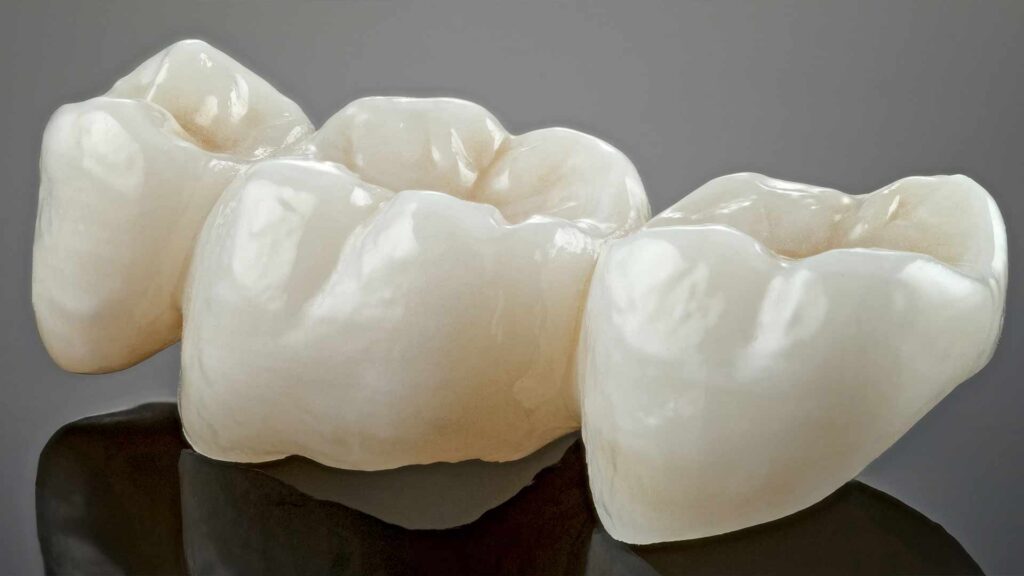 Kezelesek hidak es reszleges fogpotlasok 01 3t dental pecs